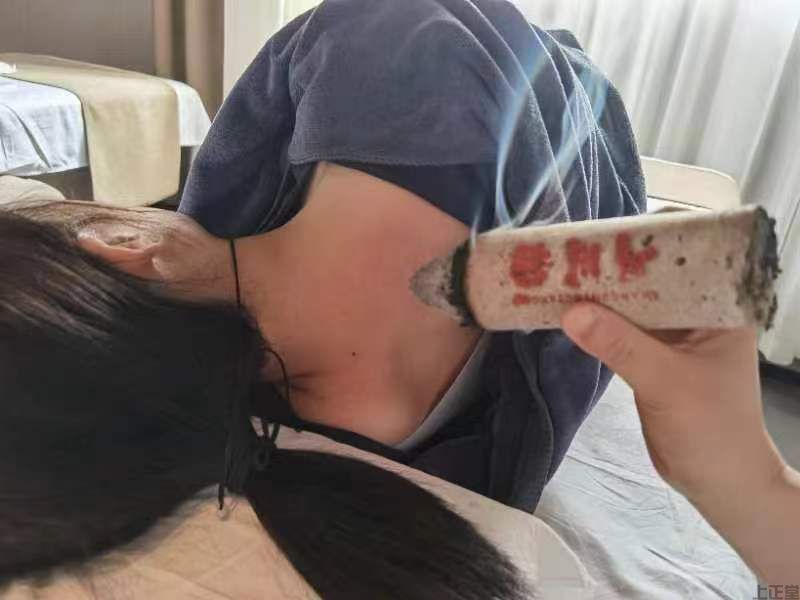 相关报道!艾灸治感冒管用吗?